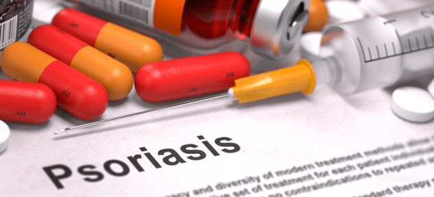médicaments contre le psoriasis