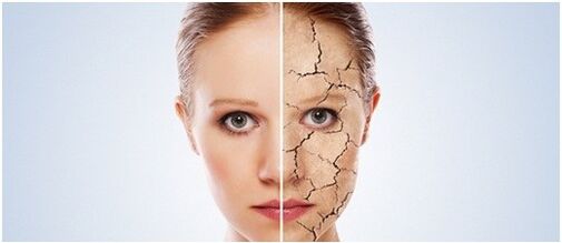 Nous traitons le psoriasis